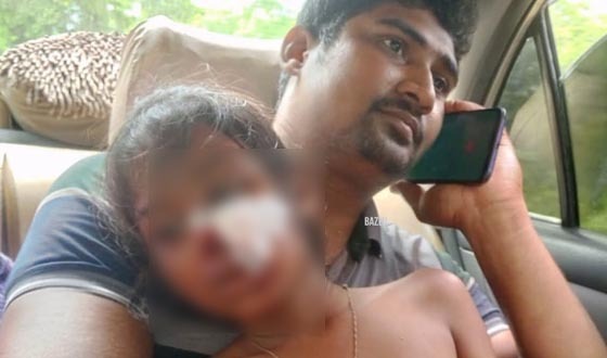 সরকারি প্রাঃ বিদ্যালয়ে ছাত্রীর মাথায় ফ্যান পড়ে গুরুত্বর জখম