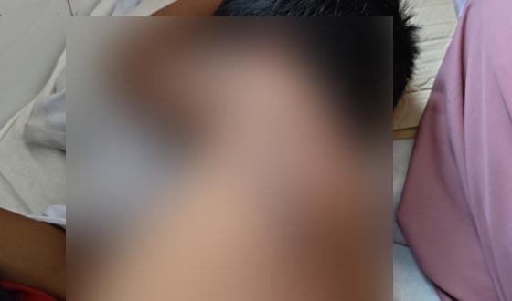 শরণখোলায় মাদ্রাসা ছাত্রকে শিক্ষকের  মারধর হাসপাতালে ভর্তি