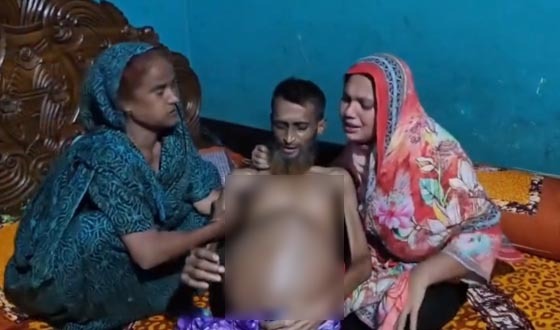 লিভার সিরোসিসে থমকে গেছে ইমরানের স্বপ্ন, চিকিৎসার খরচে নিঃস্ব পরিবার