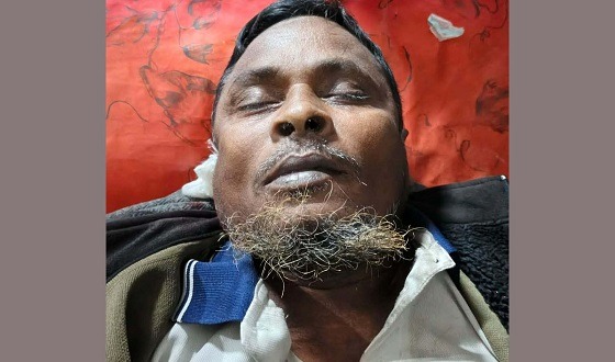 দৌলতপুরে সড়ক দুর্ঘটনায়  পথচারী নিহত