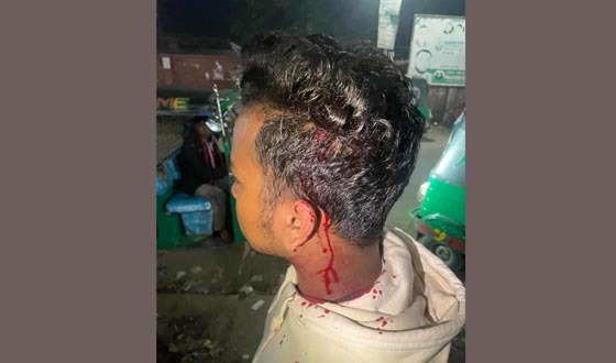 রংপুরে নলকূপের সেচ নিয়ন্ত্রণ নিয়ে সংঘর্ষে আহত ১৪