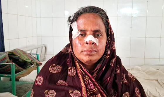 চরভদ্রাসনে শেয়ালের কামড়ে মুখমন্ডল ক্ষতবিক্ষত