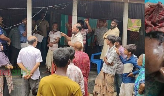 রায়গঞ্জ গভীর রাতে পরিবারের সদস্যদের জিম্মি করে মারধর ও লুটপাট