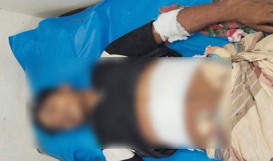 ফ্রী ফায়ার খেলাকে কেন্দ্র করে ছুরিকাঘাতে যুবক আহত