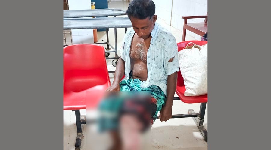 তানোরে বর্গাচাষীকে হাতুড়ি দিয়ে পিটিয়ে পাঁ ভেঙ্গে দিয়েছে প্রতিপক্ষরা