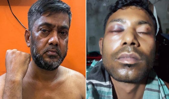 আওয়ামীলীগ ও ছাত্রলীগের দুই নেতাকে পিটিয়ে আহত