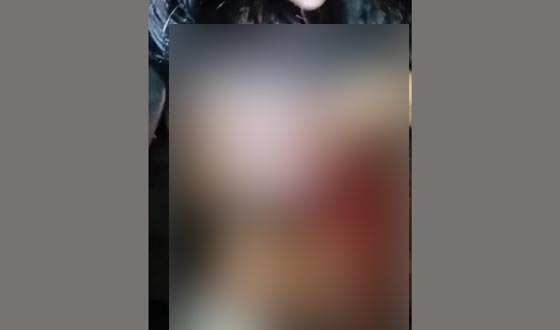 মাদক বিক্রিতে বাঁধা দেওয়ায় দুজনকে কুপিয়ে জখমের অভিযোগ