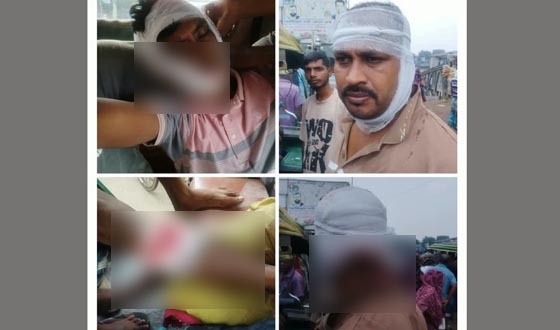 দিঘলিয়ায় দুর্বৃত্তদের হামলা, গাজীরহাটে তিন সহোদরসহ আহত ৪