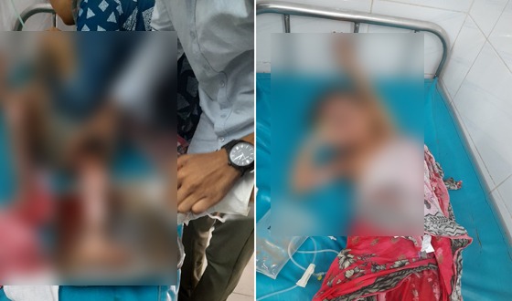 বিদ্যুৎস্পৃষ্ট দগ্ধ শিশু পাঁচদিন পরে মৃত্যু, অপর শিশু আশঙ্কাজনক