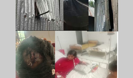কালীগঞ্জে বাড়ি ভাংচুর, লুটপাট,অন্তঃসত্ত্বা স্ত্রীর গর্ভের সন্তান নষ্ট বোনকে কুপিয়ে জখম