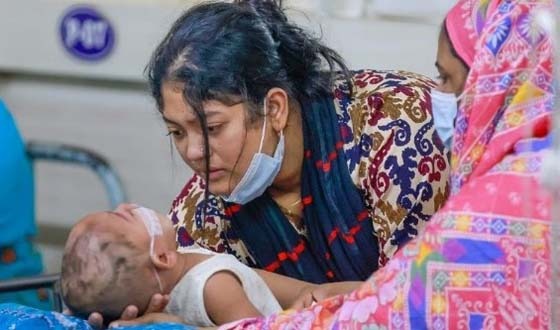 সিলেটে হামের মৃত্যু ছাড়িয়েছে ২০০শতে
