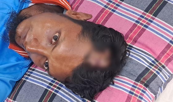 সালিশে ডেকে বাবা ও দুই ছেলেকে কুপিয়ে জখমের অভিযোগ