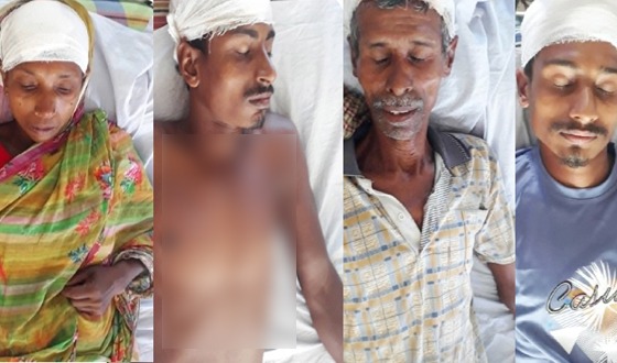 চিতলমারীতে জমি নিয়ে দুই ভাইয়ের সংঘর্ষে নারীসহ আহত ৬