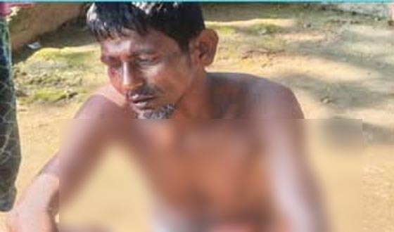 লোকালয়ে শিয়ালের হানা, স্বামী-স্ত্রীসহ আহত ৫