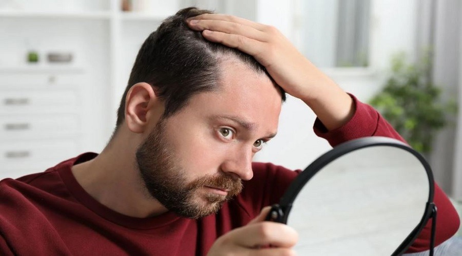 মানসিক চাপেও কি চুল পড়ে?