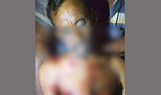 মাদকসেবনে বাধা দেওয়ায় চাচাতো ভাইকে কুপিয়ে হত্যা, আহত ১
