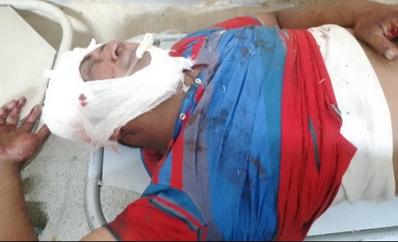 বেনাপোলে ওয়াজ মাহফিলে যাওয়ার পথে যুবদল কর্মীকে কুপিয়ে জখম