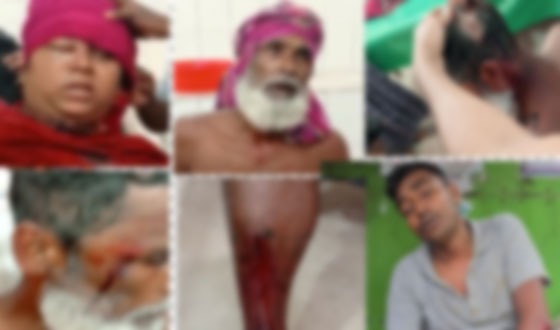 বাউফলে দু’গ্রুপের সংঘর্ষে সেনা সদস্যসহ আহত ১৪