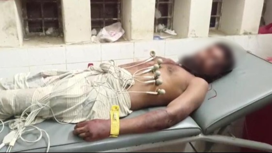 ধামইরহাটে দূর্বৃত্তের হামলায় ছাগল ব্যবসায়ী খুন