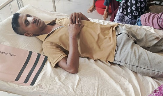 তানোরে পূর্ব শক্রুকার জেরে যুবককে বেধড়ক মারধর