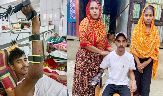 জুলাইযোদ্ধার প্রতিটি মুহুর্ত কাটে স্প্লিন্টারের যন্ত্রণায়