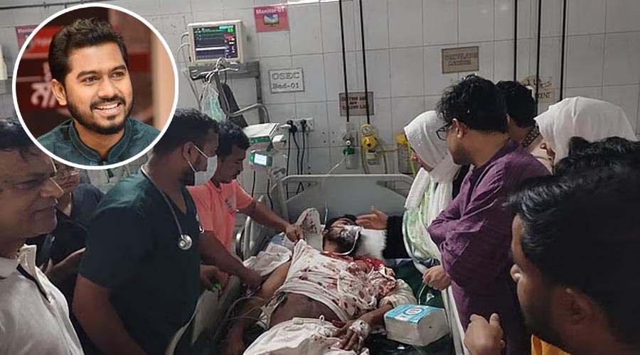 গুরুতর আহত নুরুল হক, মাথায় আঘাত ও নাকের হাড় ভেঙেছে