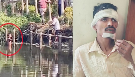 চোর সন্দেহে আটক ১ : পুলিশের গাড়ি থেকে লাফিয়ে পালানোর চেষ্টা