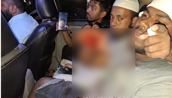 গজারিয়ায় মনোনয়নকে কেন্দ্র করে বিএনপির দুই গ্রুপের সংঘর্ষে আহত ৭