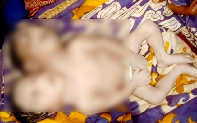 নীলফামারীতে এক দেহে দুই মাথা নবজাতকের জন্ম, কিছুক্ষণ পর মৃত্যু