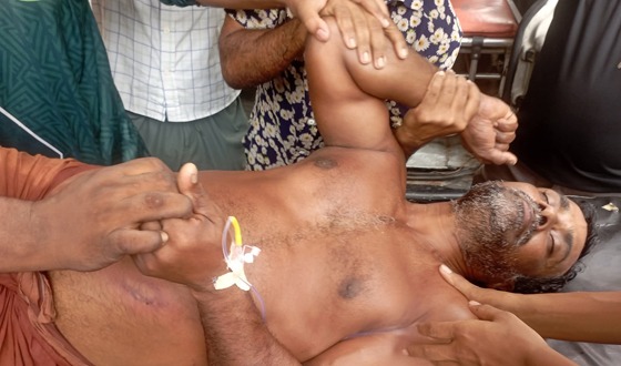 পাইকগাছায় দুর্বৃত্তের হামলায় ঘের ব্যবসায়ী আহত