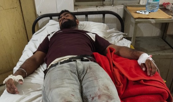 গজারিয়ায় হাতুড়ি দিয়ে পিটিয়ে ২ যুবককে আহত