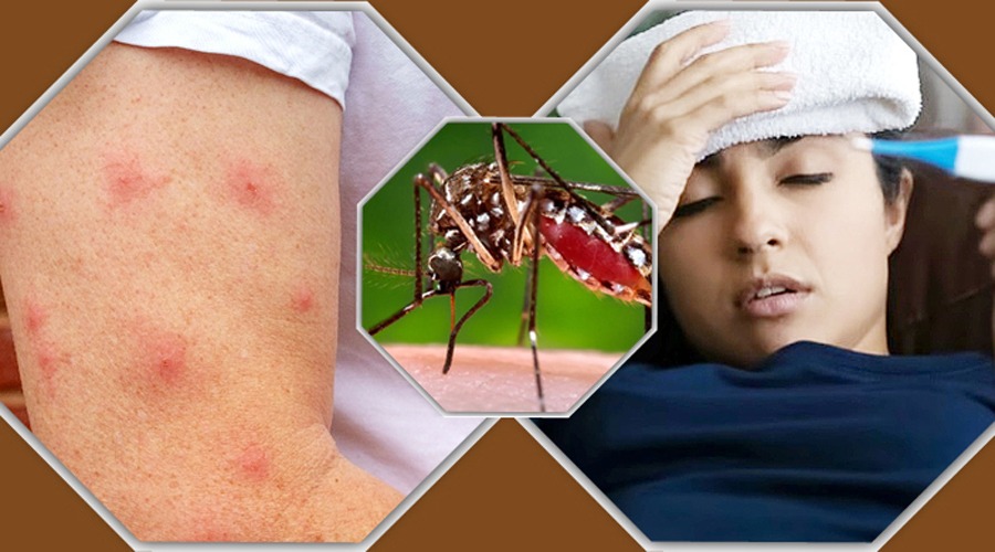 ডেঙ্গুতে একদিনে ঝরলো ৩ প্রাণ, হাসপাতালে ভর্তি ৪০৯