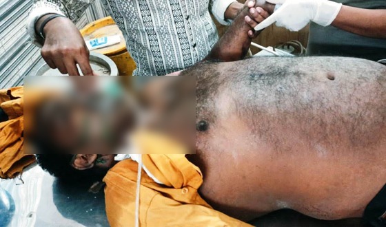 কেশবপুরে সড়ক দুর্ঘটনায় নিহত ১