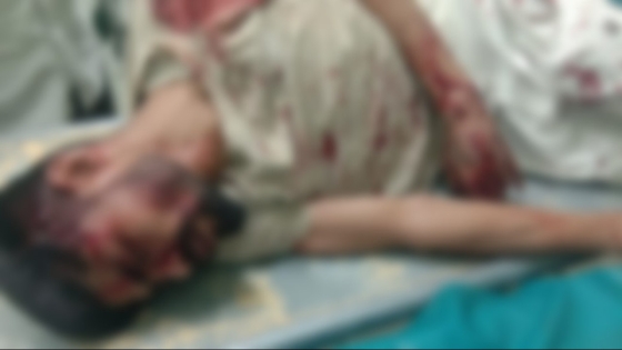 রাজশাহীতে আধিপাত্য বিস্তার নিয়ে তাঁতী দল নেতাকে কুপিয়ে আহত