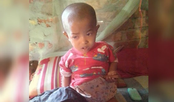 ক্যান্সারে আক্রান্ত নুসরাতের চিকিৎসায় সাহায্য প্রয়োজন