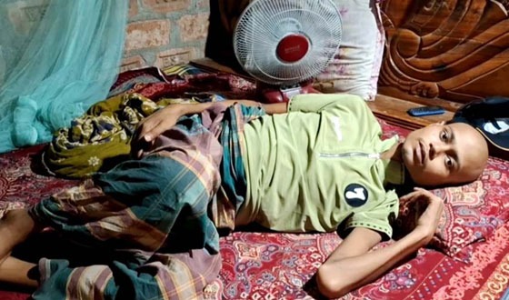 মরণ ব্যাধি ক্যান্সারে ভূগছে দুর্গাপুরের কলেজ ছাত্র জুলহাস