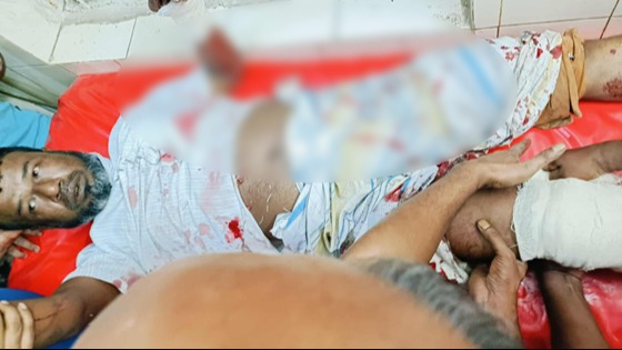 ব্যবসায়ীকে প্রকাশ্যে কুপিয়ে হত্যার চেষ্টা