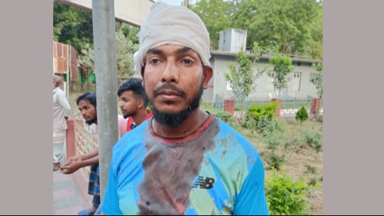 তানোরে প্রতিবন্ধীকে কেন্দ্র করে সংঘর্ষ, আহত ৪