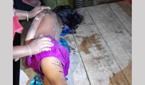 ঘোড়াঘাটে বৈদ্যুতিক তারে জড়িয়ে শিশুর মৃত্যু