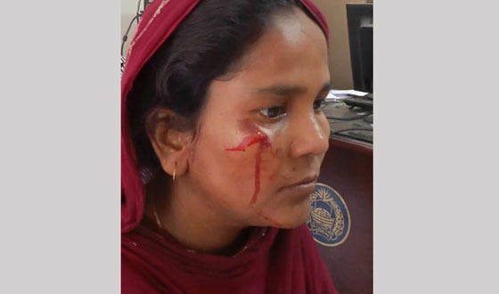 বাঘায় প্রতিবেশির মারধরে আহত আনছার সদস্য