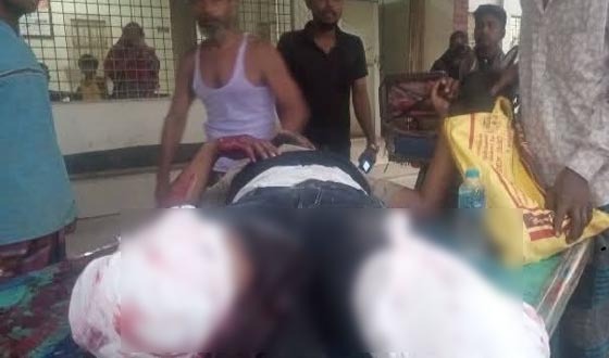 আত্রাইয়ে ট্রেনের চাকায় পিষ্ট হয়ে পুলিশ সদস্যের দুই-পা বচ্ছিন্ন