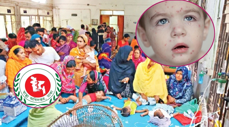 ২৪ ঘণ্টায় হাম ও এর উপসর্গে ৭ জনের মৃত্যু, আক্রান্ত বহু
