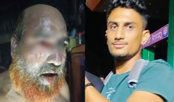 গৃহকর্তার চোখে খোচা দিয়ে পালালো চোর