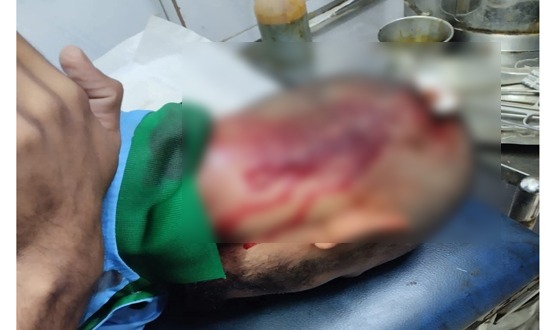 রাজারহাটে ছাত্রদল-ছাত্রশিবির সংঘর্ষ, আহত ৬