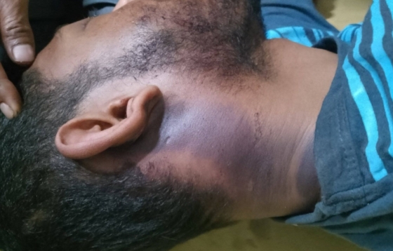 ভূরুঙ্গামারীতে শ্বশুরবাড়ি থেকে স্ত্রীকে আনতে গিয়ে যুবকের মৃত্যু