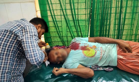 মান্দায় প্রতিপক্ষের লাঠির আঘাতে ১ জন আহত