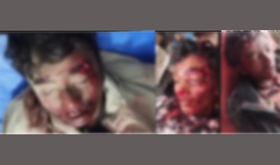 দৌলতপুরে সড়ক দুর্ঘটনায় ৩ শিক্ষার্থীর মৃত্যু