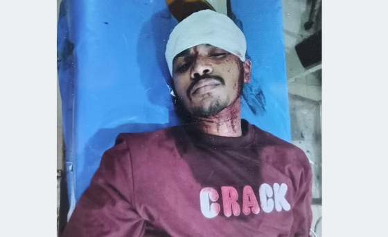 ভূরুঙ্গামারীতে ধারালো অস্ত্রের কোপে রাজন গুরুতর আহত