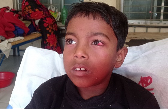 বালিয়াকান্দিতে ঘাস চুরির অপবাদ দিয়ে শিশুকে নির্যাতন