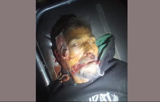 মোটরসাইকেলের ধাক্কায় বৃদ্ধ নিহত